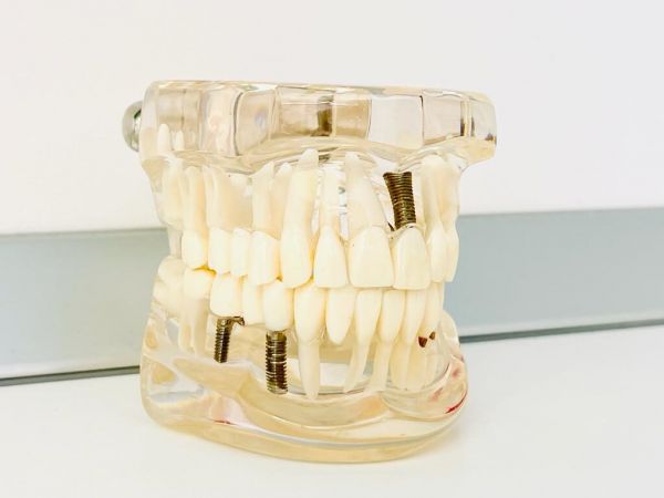 Heinerich - Clinica Stomatologica Sector 6 - Implant Dentar Drumul Taberei poza 8