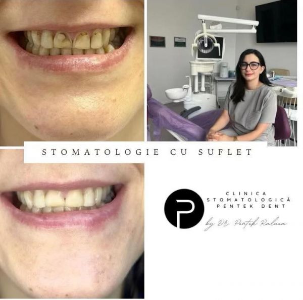 Clinica stomatologica Pentek Dent poza 13