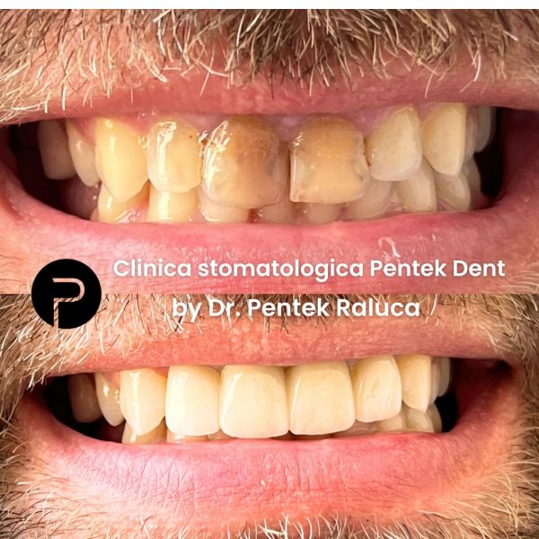 Clinica stomatologica Pentek Dent poza 10