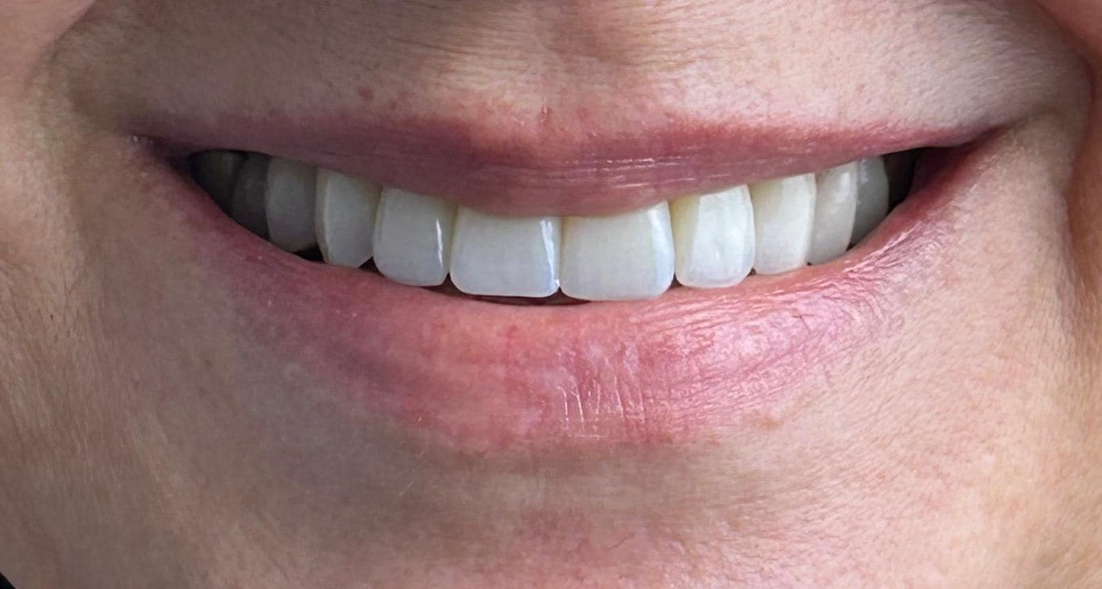 M&M Dental Team Bucuresti poza 14