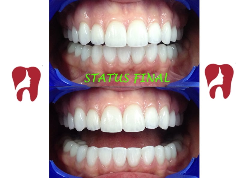 Dental Chic - Clinică Stomatologică Cluj - Implant Dentar Cluj - Dinti Ficsi Cluj poza 8