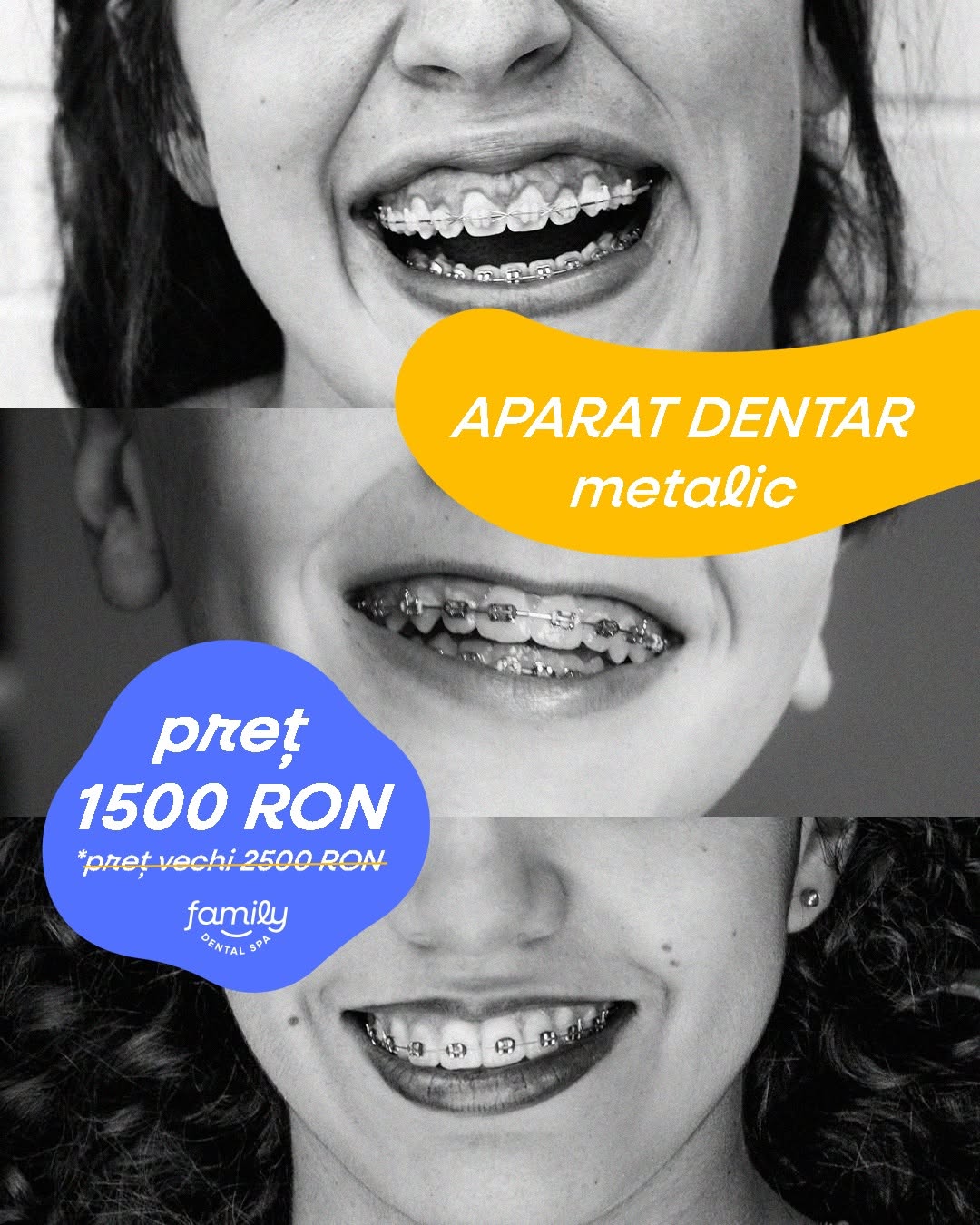 Family Dental Spa Otopeni - Implant Dentar si Dinti Ficsi poza 8