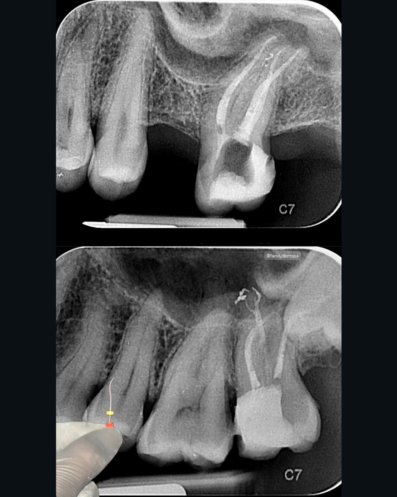Family Dental Spa Otopeni - Implant Dentar si Dinti Ficsi poza 10