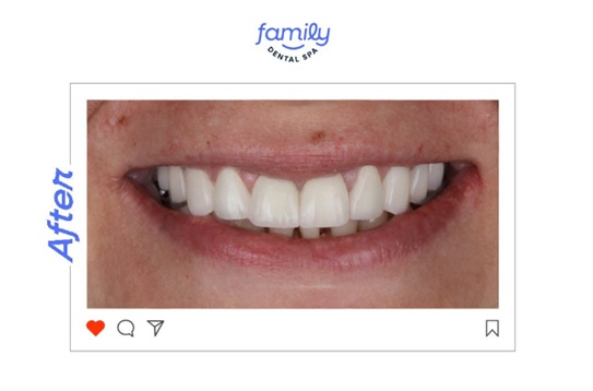 Family Dental Spa Periș - Implant Dentar si Dinti Ficsi poza 5