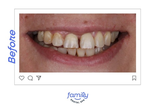 Family Dental Spa Periș - Implant Dentar si Dinti Ficsi poza 4