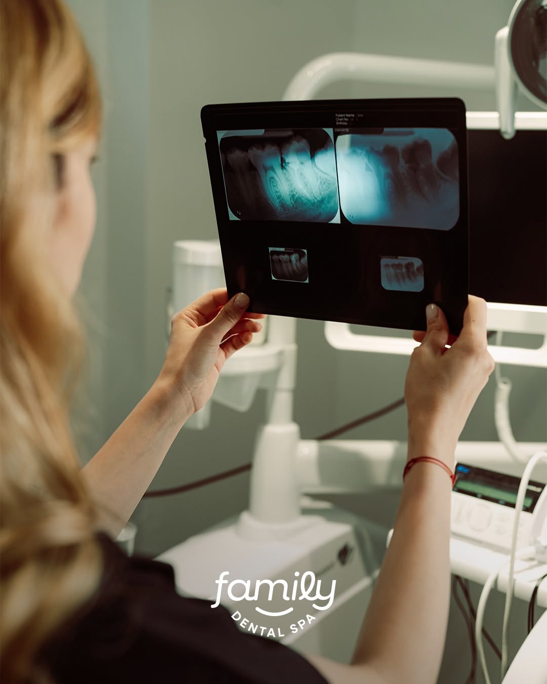 Family Dental Spa Periș - Implant Dentar si Dinti Ficsi poza 9