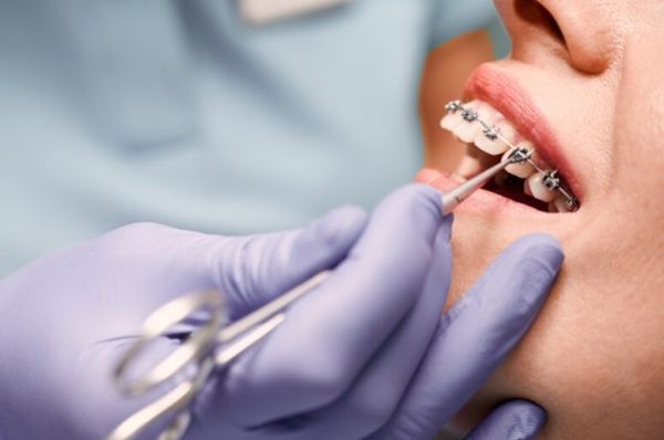 Onudent - Dentist Sector 6 - Implant Dentar Sector 6 poza 2