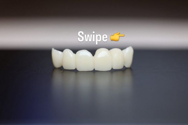 Oralis Premium Dental Clinic - Implant Dentar si Dinti Ficsi Galati poza 7
