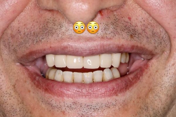 Oralis Premium Dental Clinic - Implant Dentar si Dinti Ficsi Galati poza 8