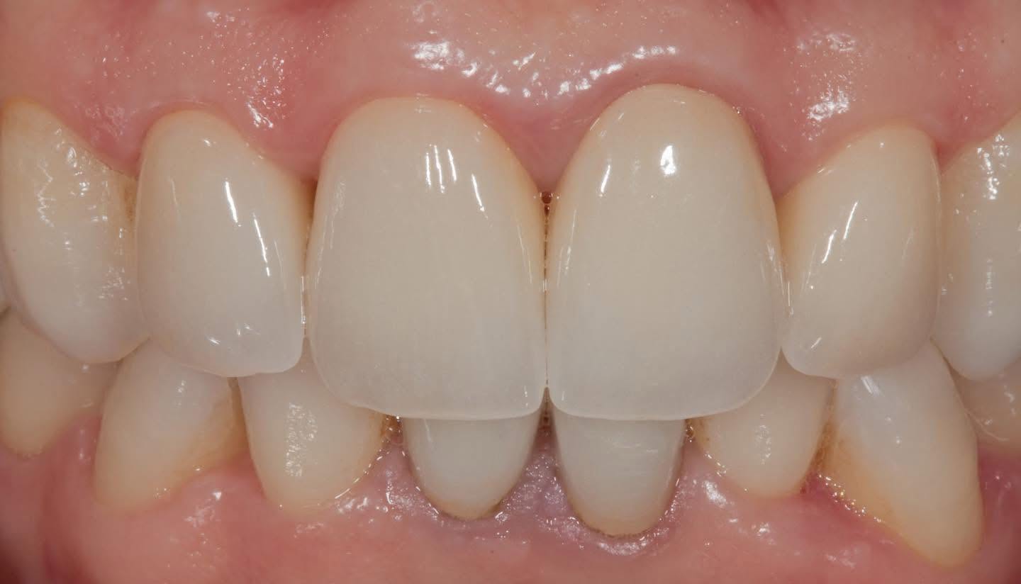 Clinica Stomatologică Dr. Dragus - Implant Dentar si Dinti Ficsi Sector 1 Bucuresti poza 8
