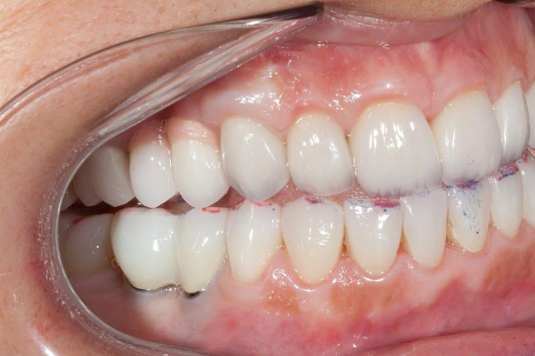 Clinica Stomatologică Dr. Dragus - Implant Dentar si Dinti Ficsi Sector 1 Bucuresti poza 7