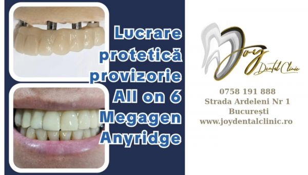 Joy Dental Clinic Srl poza 10