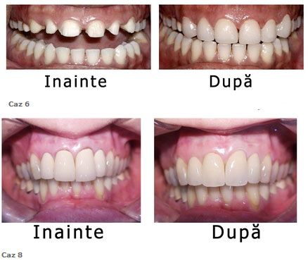 Dental Praxis dr. Valeanu Andrei poza 3