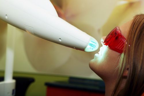 EUROCOM - Lampi de albire Beyond, Lasere dentare, microscoape endodontie poza 1