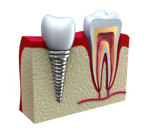 Clinica Lucas Dent (Implant Dentar Vaslui) poza 0