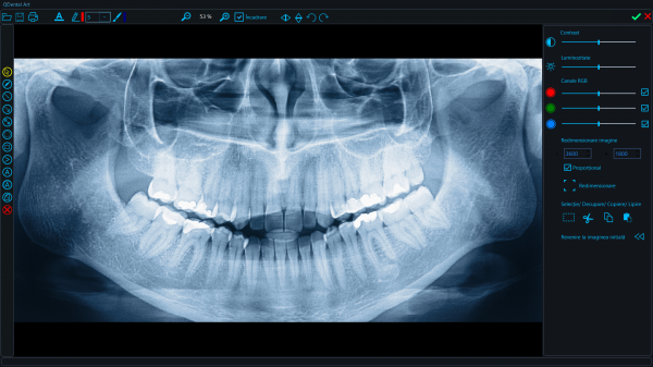 Qdental - Software cabinete si clinici stomatologice poza 3