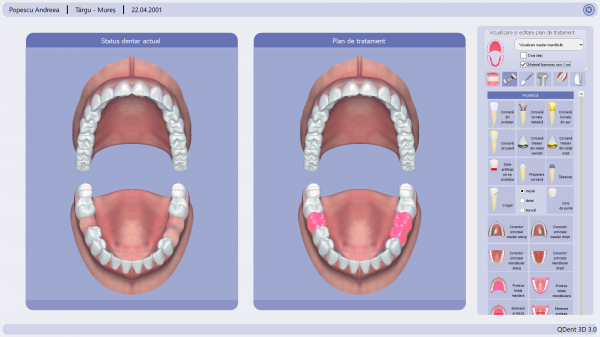 Qdental - Software cabinete si clinici stomatologice poza 4