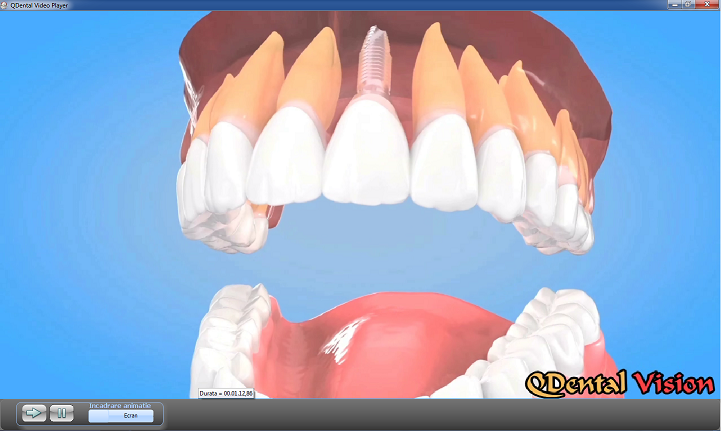PFA Capota Radu Mircea poza 5
