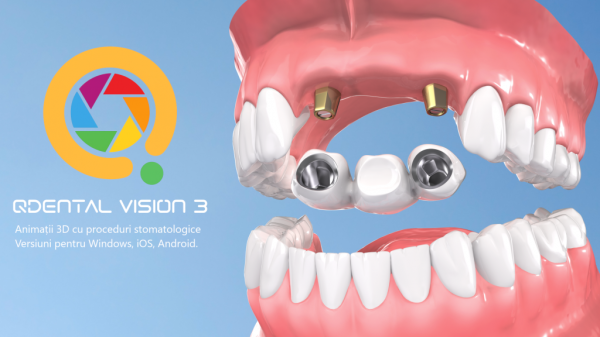 Qdental - Software cabinete si clinici stomatologice poza 5
