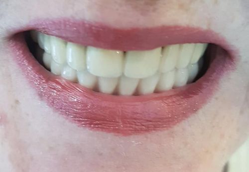 DENTAL PRIVILEGE poza 10