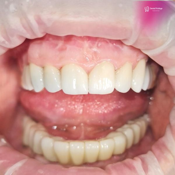 DENTAL PRIVILEGE poza 24