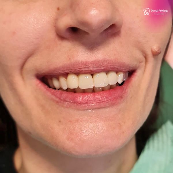 DENTAL PRIVILEGE poza 27