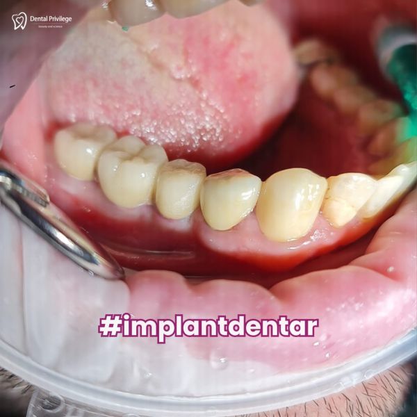 DENTAL PRIVILEGE poza 28
