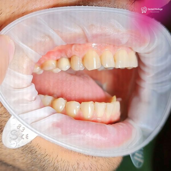 DENTAL PRIVILEGE poza 25
