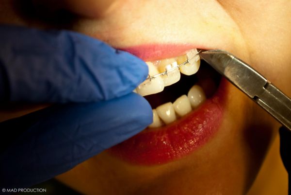 Dentist-Hasdeu-Fogaszat poza 7