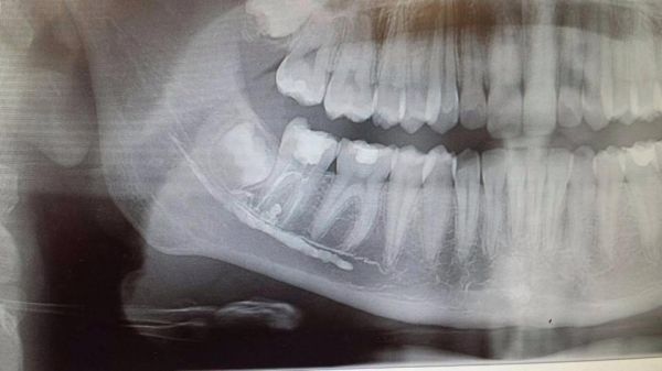Dentist-Hasdeu-Fogaszat poza 8