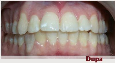 Dr. Vlad Cristea - Aparat Ortodontic poza 2