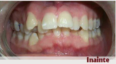 Dr. Vlad Cristea - Aparat Ortodontic poza 1