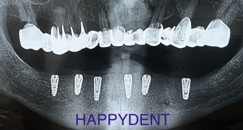 Sc Happydent Srl poza 8