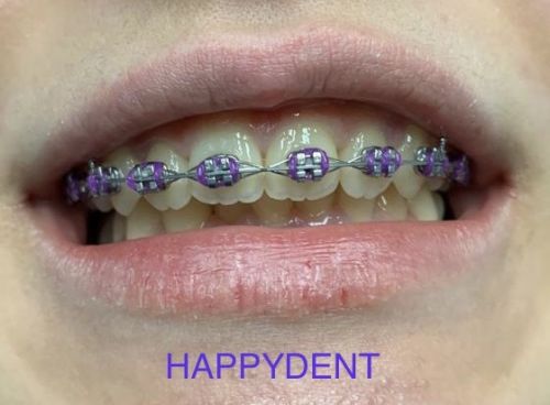 Sc Happydent Srl poza 6