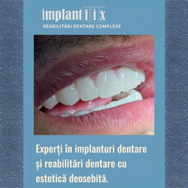 ImplantFix - Clinica de Implanturi dentare poza 8