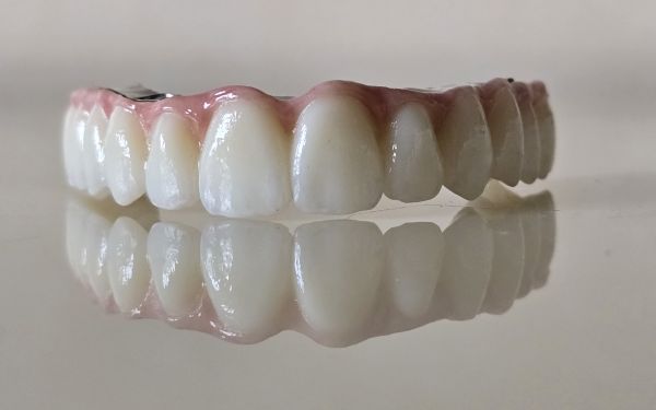 ImplantFix - Clinica de Implanturi dentare poza 3