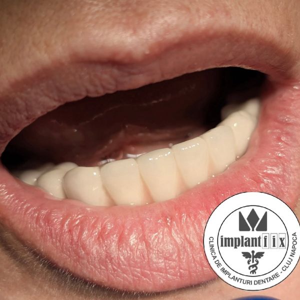 ImplantFix - Clinica de Implanturi dentare poza 20