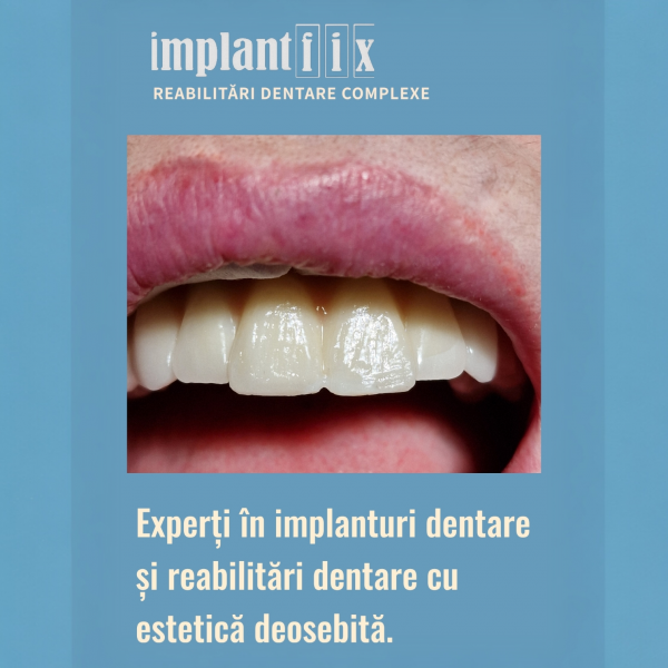 ImplantFix - Clinica de Implanturi dentare poza 9