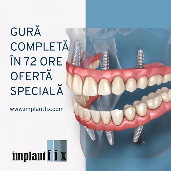 ImplantFix - Clinica de Implanturi dentare poza 10