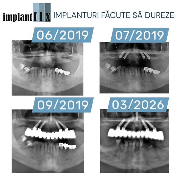 ImplantFix - Clinica de Implanturi dentare poza 19