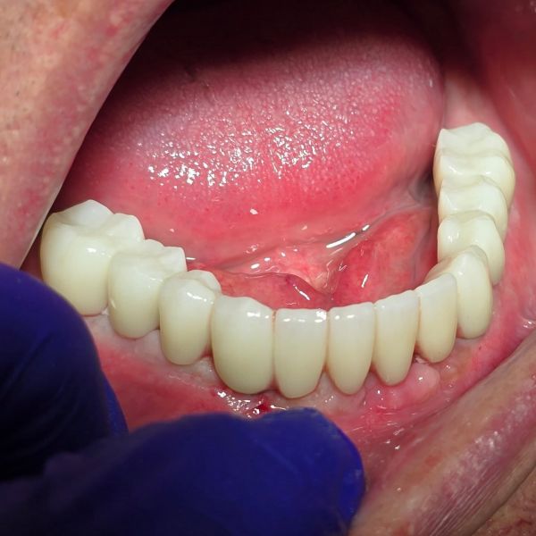 ImplantFix - Clinica de Implanturi dentare poza 18