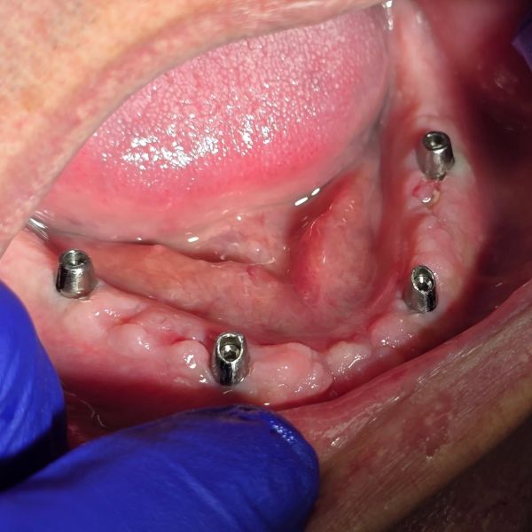 ImplantFix - Clinica de Implanturi dentare poza 17