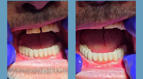 ImplantFix - Clinica de Implanturi dentare poza 14