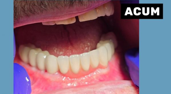 ImplantFix - Clinica de Implanturi dentare poza 12