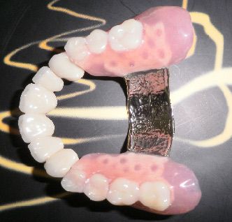 M&I Best Dent poza 1