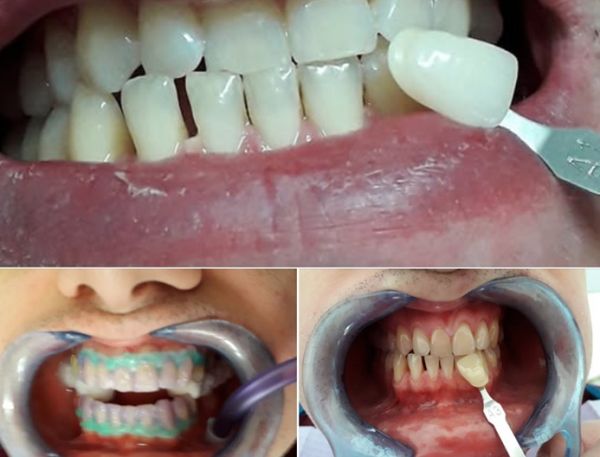 SANDOOR DENT poza 10