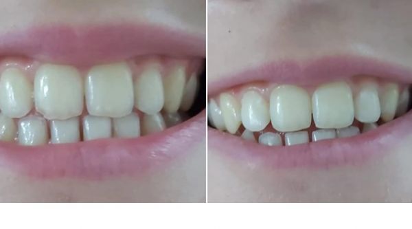 SANDOOR DENT poza 9