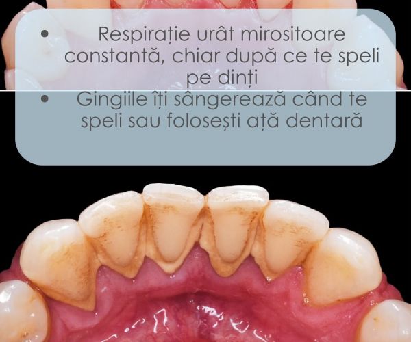 CMI  Hleihil Mahmod poza 11