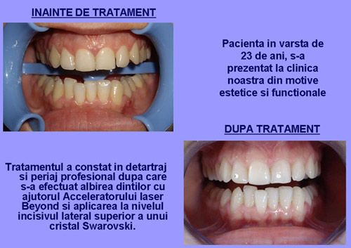 Clinica dentara Dr.Mikaela Oprisan poza 4