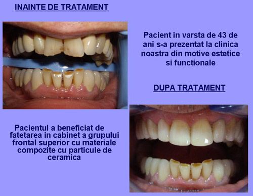 Clinica dentara Dr.Mikaela Oprisan poza 5